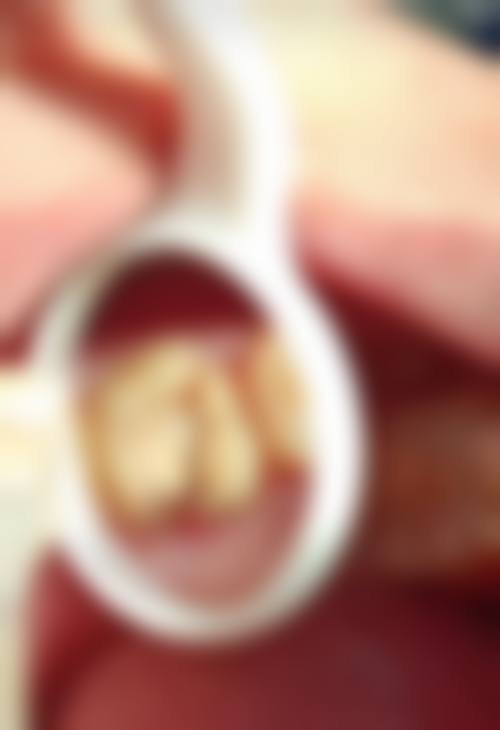 邵阳邵东陈氏口腔擅长项目有哪些?