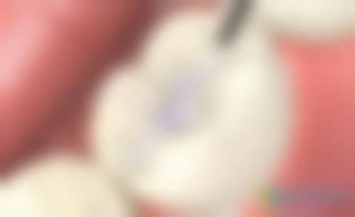 浙江杭州萧山告白美学口腔门诊部擅长项目有哪些?