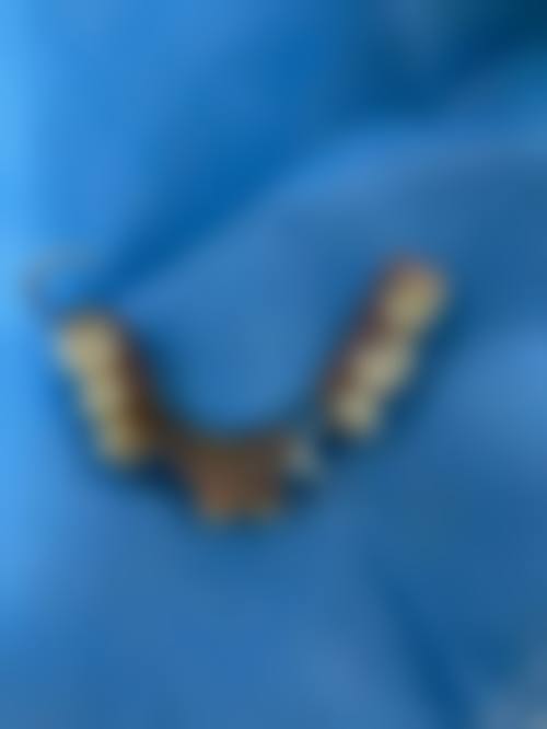 甘肃白银会宁县博邦口腔医生团队解析