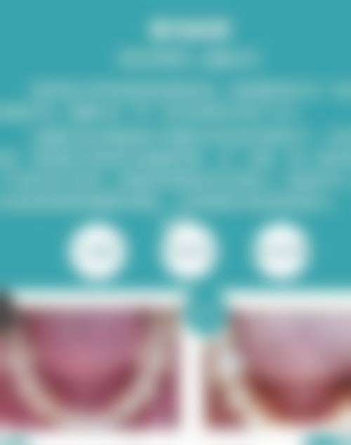 白银会宁博邦齿科(会宁店)医生团队解析