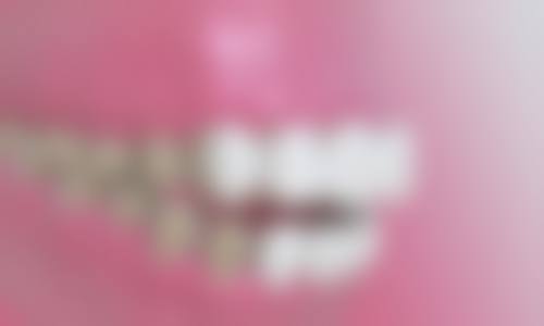 江苏无锡宜兴贝壳口腔口碑评价