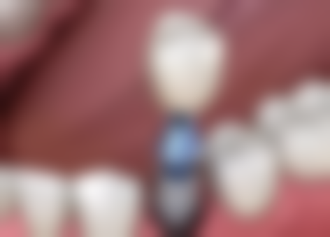 海南海口中齿口腔擅长项目有哪些?