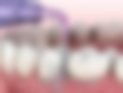 广州万众口腔医生团队解析