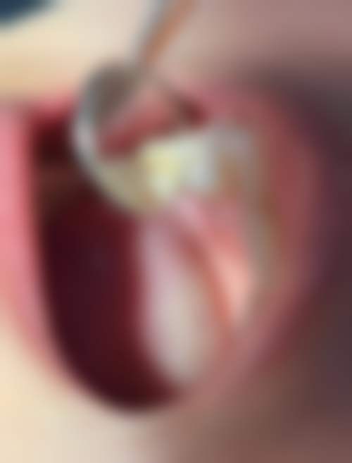 曹州口腔医院医生团队解析