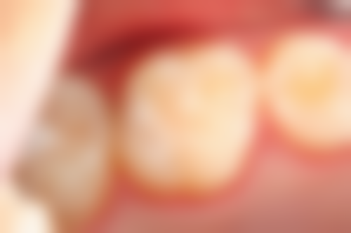 安徽阜阳颍上金燕口腔医生团队解析