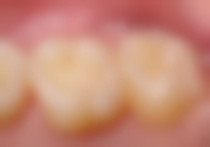 山东临沂沂水沂博士儿童口腔擅长项目有哪些？