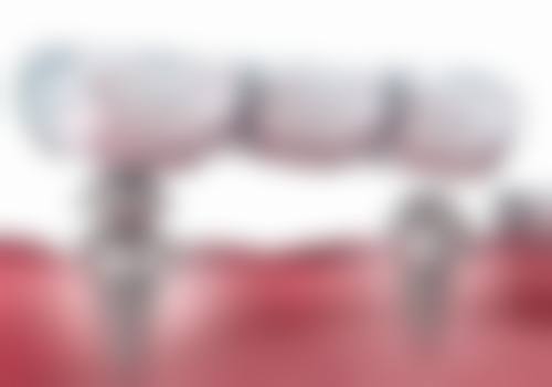 北京美呀奥仕口腔(丰台店)医生团队解析