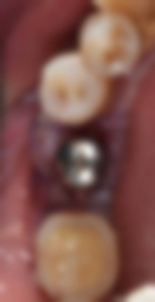 宏哲斯迈尔口腔门诊部(百花店)价格参考