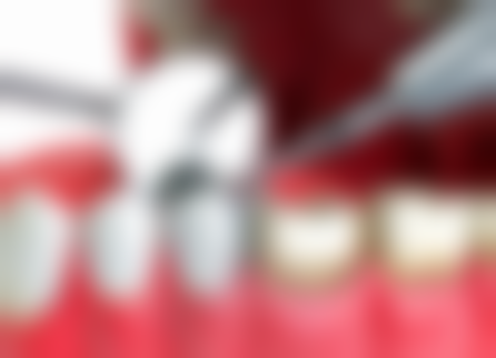 长沙优享新天地口腔门诊部2026价格表参考