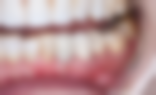 诸城周升德口腔医生团队解析