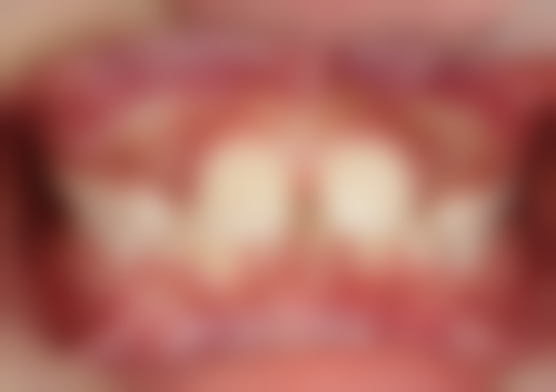 谢冰擅长项目列表