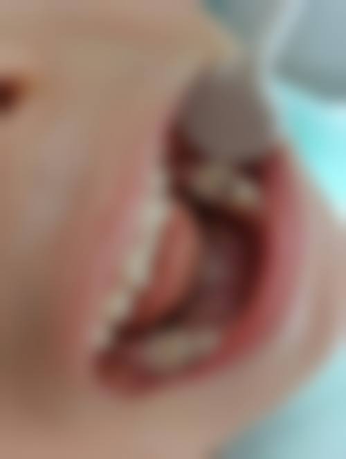 贵州毕节牙友口腔(杜鹃店)医生团队解析