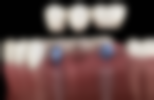 成都瑞森口腔诊所2026价格表参考