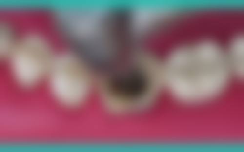 广东广州张燕口腔门诊部擅长项目有哪些？