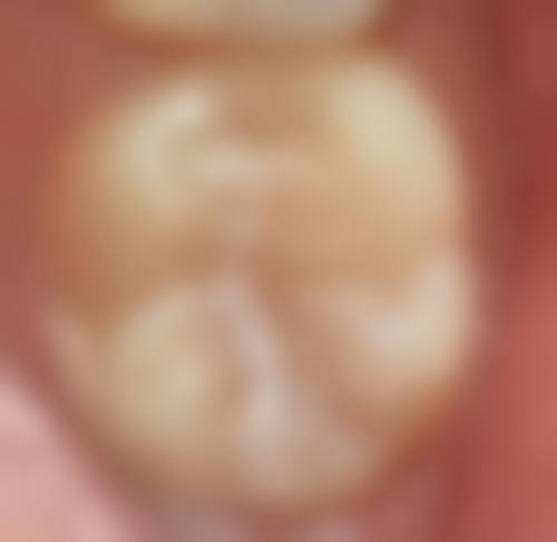 南京江宁卡瓦口腔医生团队解析