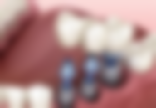 西安泰康拜博口腔(木塔寨分院)擅长项目有哪些？