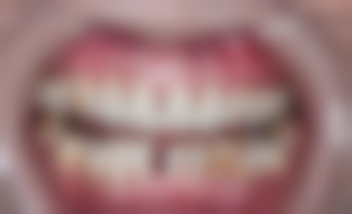 西安泰康拜博口腔(木塔寨分院)2026价格表参考