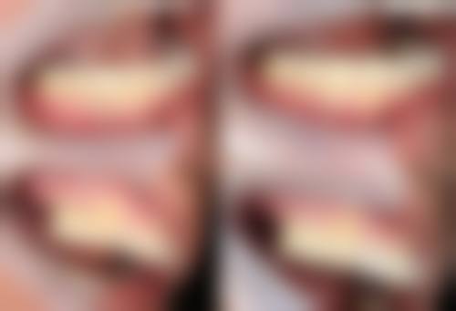 西安泰康拜博口腔(木塔寨分院)医生团队解析