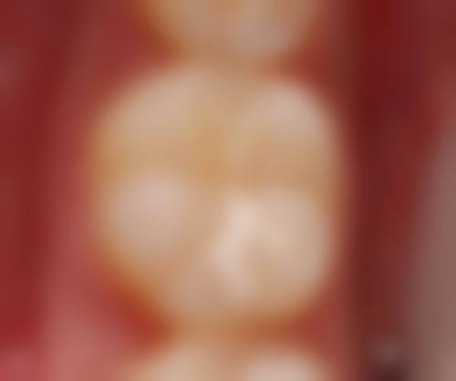 沈阳于洪拜尔口腔医生团队解析