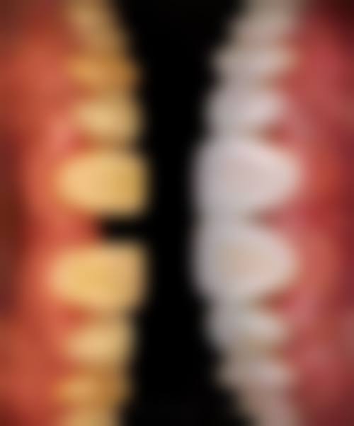 广东东莞莞嘉口腔医生团队解析