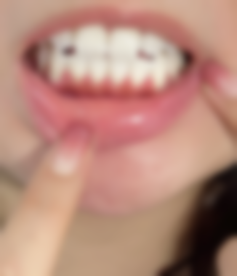 南阳市口腔医院口腔颌面外科I病区2026价格表参考