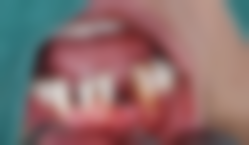 付丽娟患者评价