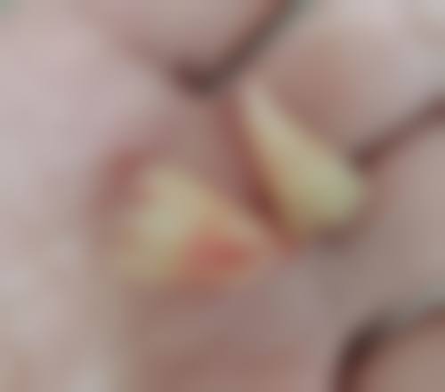 江苏盐城李玉洁惠康口腔口碑评价