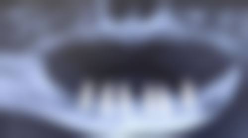 福州舒华口腔门诊部擅长项目有哪些？