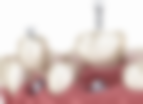 梅州美程口腔技术设备怎么样？