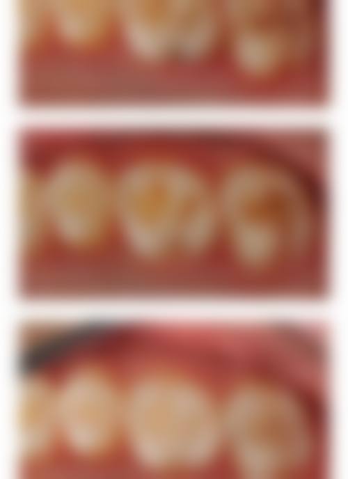 吴兴擅长项目列表