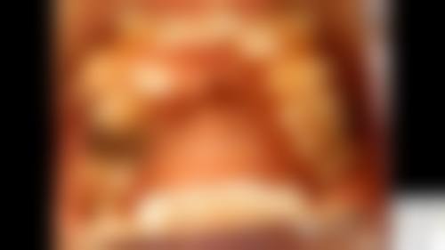 瑞德口腔医院·广州正畸·TOP1店（番禺员岗院区）2026价格表参考