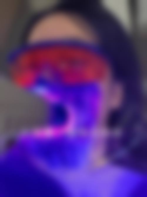 山东德州临邑县康贝佳口腔口碑评价
