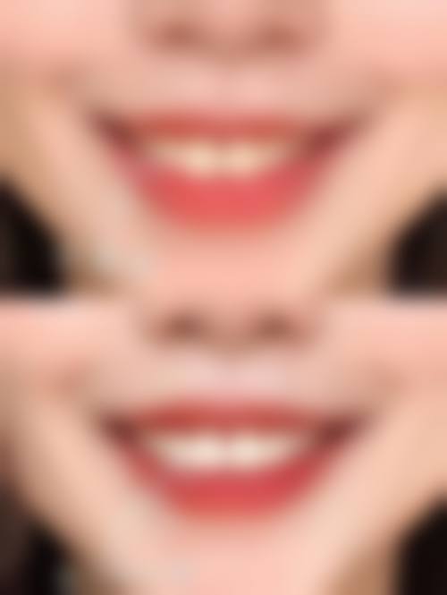 江门恩平雅力健口腔门诊部价格表参考