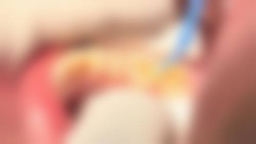 汉寿县华尔口腔诊所2026价格表参考