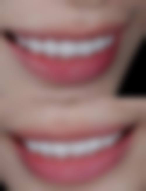 赵正擅长项目列表
