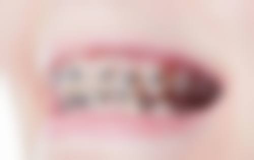 东莞特美口腔医院技术设备怎么样？
