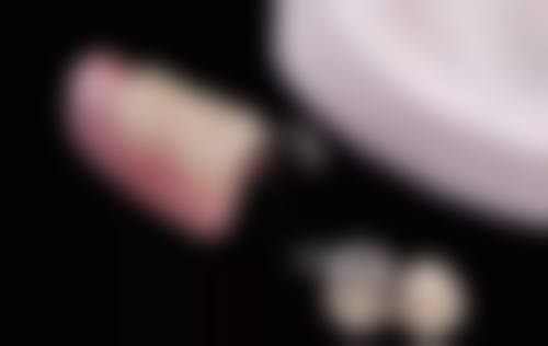 苏州工业园区冯玉华口腔口碑评价