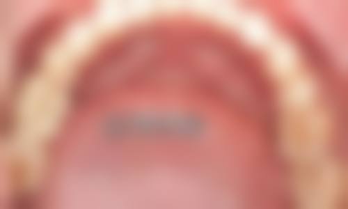【溧阳奇诺尔口腔真实口碑评价】