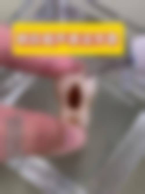【株洲左金璈口腔诊所预约挂号方式】