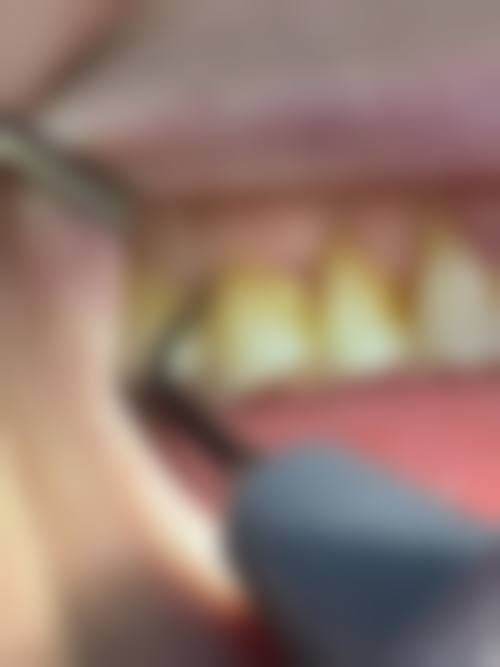 【株洲左金璈口腔诊所特色诊疗项目】