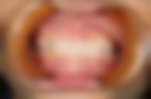 【山西省人民医院口腔正畸科特色诊疗项目】
