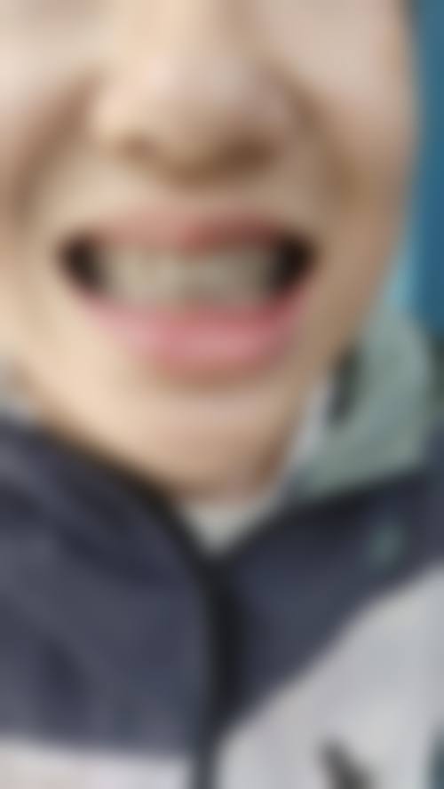 【山西省人民医院口腔正畸科真实口碑评价】