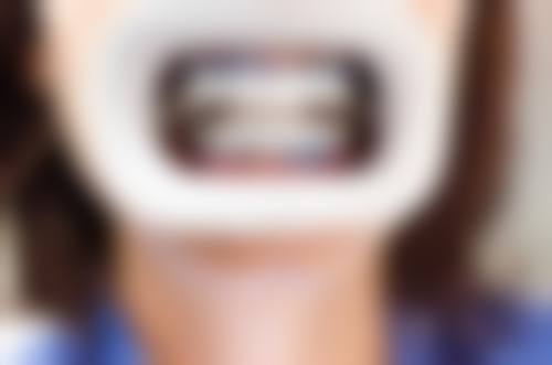 【西安恒慧口腔门诊部价格表参考】