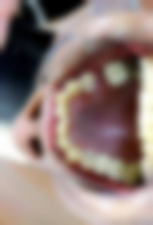 【河池市第三人民医院口腔科真实口碑评价】