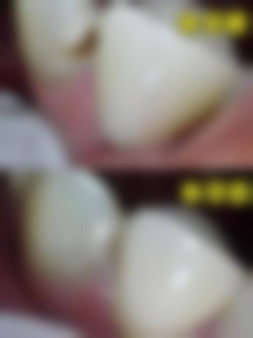【景德镇珠山区王祖庆口腔诊所价格表参考】