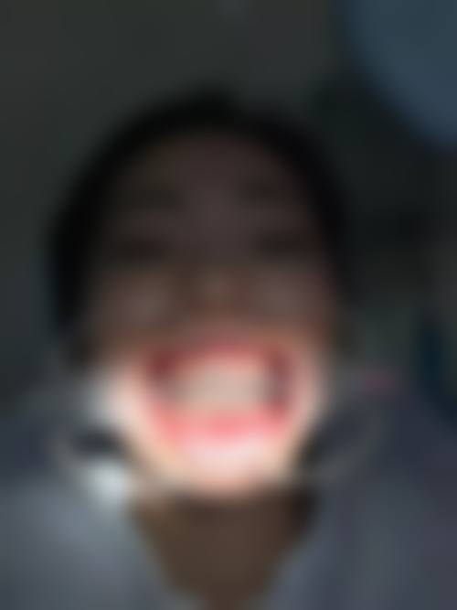 【江苏徐州亚伟口腔价格表参考】