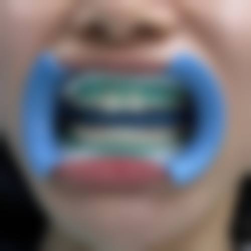 【陕西汉中众禾口腔门诊部预约挂号方式】