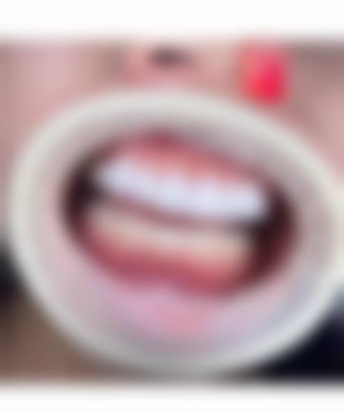 【鸡西微笑口腔门诊部常见问题解答】