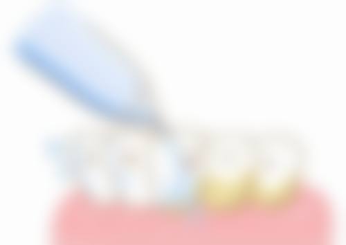 【北京科智佳颐口腔门诊部特色诊疗项目】