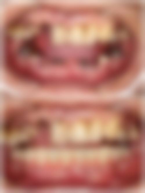 【广东江门侨邑口腔连锁特色诊疗项目】